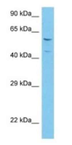 Angiopoietin-like Protein 6/ANGPTL6 Rabbit anti-Human, Polyclonal, Novus
